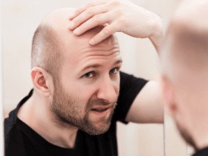 bald man scratching is head in front of a mirror